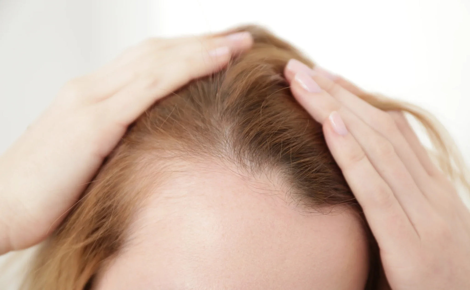 Why Your Hair Falls More in Winter — And How to Stop It