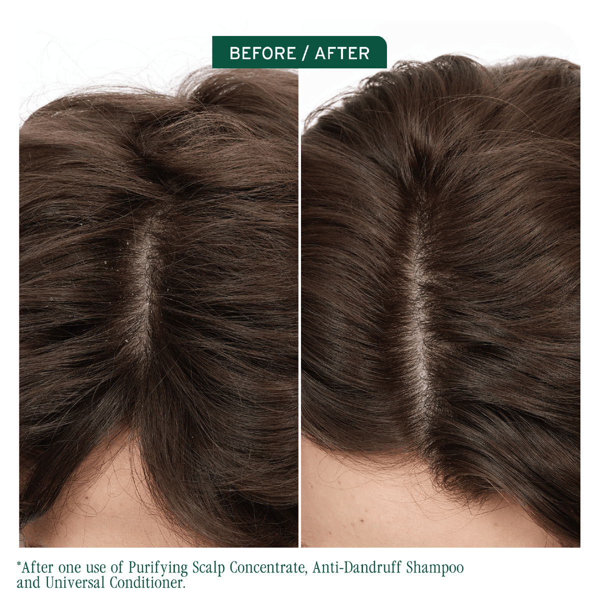 Biolage Scalp Sync Anti-Dandruff Shampoo to remove build up for a clean scalp
