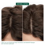Biolage Scalp Sync Anti-Dandruff Shampoo to remove build up for a clean scalp