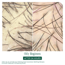 Biolage Scalp Sync Oil Balancing Serum 50ml