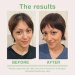 Mumms Scalp Serum for noticeably less hair fallout